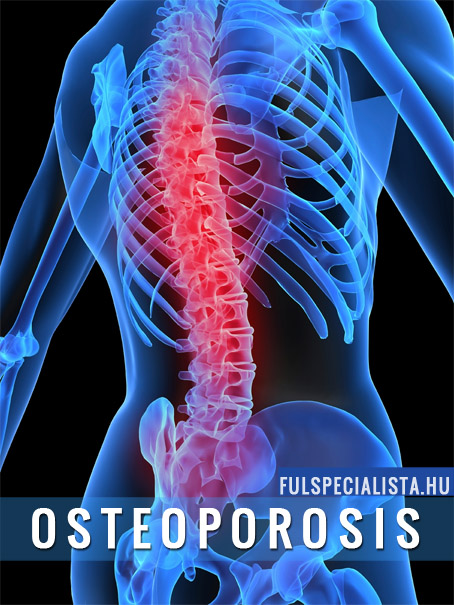 osteoporosis oszteoporózis csontritkulás savasodás