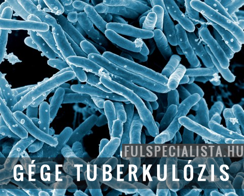 gége tuberkulozis tbc