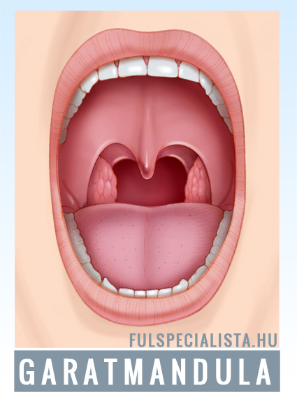 ízületi fájdalom tonsillitis)