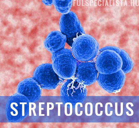 mandulagyulladás streptococcus fertőzés gócos mandula