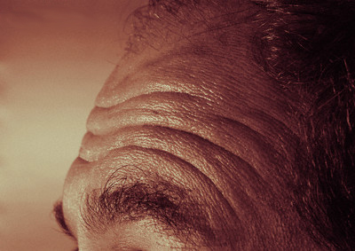 bőr cigarettázás arc ráncosodása öregedés dohányzók vonzereje öregség cigarettázás bőr hajszálerek vastag bőr kiserek áteresztő képessége Dohányzás cigaretta bőr csökkent vérellátása, kötőszövet