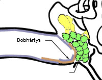 fül betegség lényege elszarusodó laphám szaru gyöngy fülben cholesteatoma koleszteatóma kialakulása fülműtét koleszteatóma kezelése laphám cysta keratintermelő alapréteg, matrix a cysta ciszta belseje keratin a cysta hagymalevél szerű felhalmozódás. középfül szarugyön hámgyöngyök, cholesteatomák koleszteatómák kialakulására koleszteatóma kezelése fülkürtfunkció károsodás negatív nyomás dobhártya szívódik rostrendszer elpusztul dobhártya