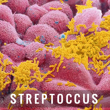 bakteriális torokgyullads streptoccus fertőzés